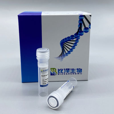 Recombinant Monkeypox Virus (MPXV) M1R Protein, His Tag